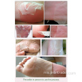 Removal Callus mati kulit kaki penjagaan topeng